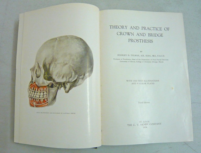Tylman,THEORY AND PRACTICE OF CROWN AND BRIDGE PROSTHESIS[odontoiatria,protesi