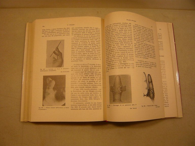 Vincenzo Palumbo, PICCOLA CHIRURGIA, 1980