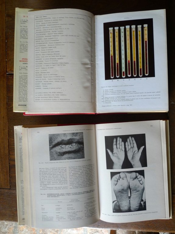 Wintrobe,EMATOLOGIA CLINICA,1973 Piccin[manuale,MEDICINA