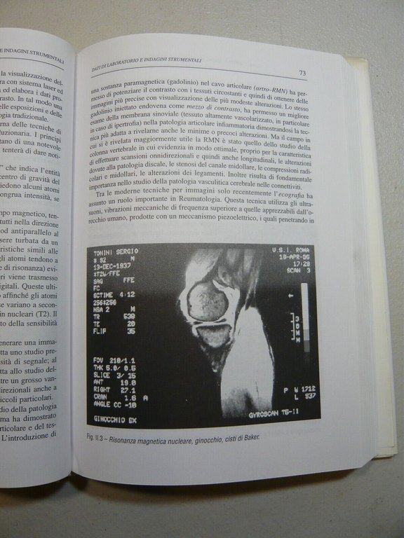 Zoppini,FONDAMENTI DI REUMATOLOGIA,Aracne editrice, Roma, Ottobre 1996