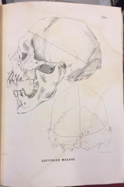 MÉMOIRE SUR LES MICROCÉPHALES OU HOMMES-SINGES.