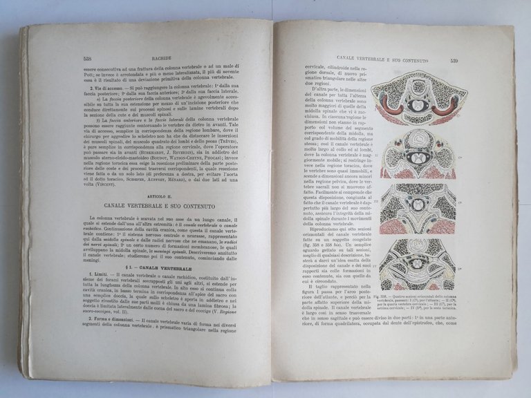 ANATOMIA TOPOGRAFICA di Testut e Jacob 2 volumi 1922 UTET …
