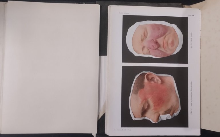 ATLANTE DELLE MALATTIE DELLA PELLE E MALATTIE VENEREE di Jacopini …