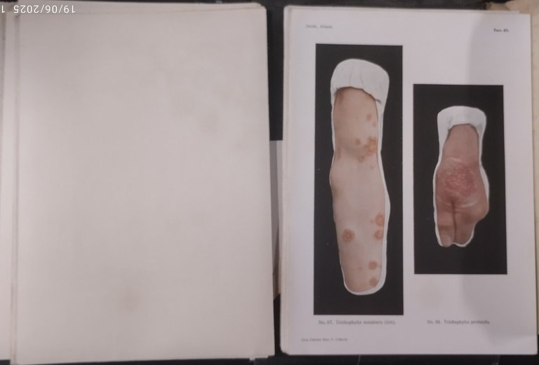 ATLANTE DELLE MALATTIE DELLA PELLE E MALATTIE VENEREE di Jacopini …