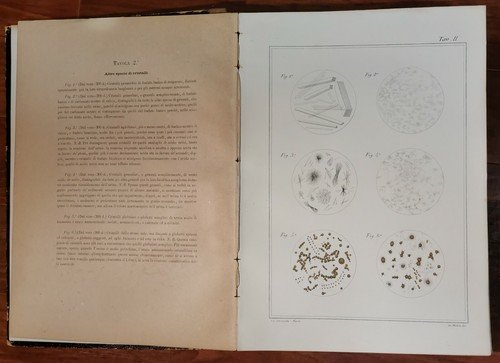 ATLANTE DI MICROSCOPIA CLINICA Gaetano Primavera 1886 Petruzzelli 68 litografie