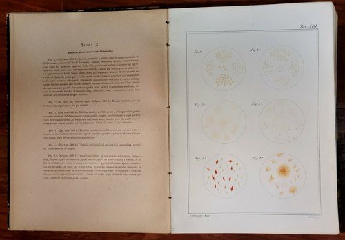 ATLANTE DI MICROSCOPIA CLINICA Gaetano Primavera 1886 Petruzzelli 68 litografie