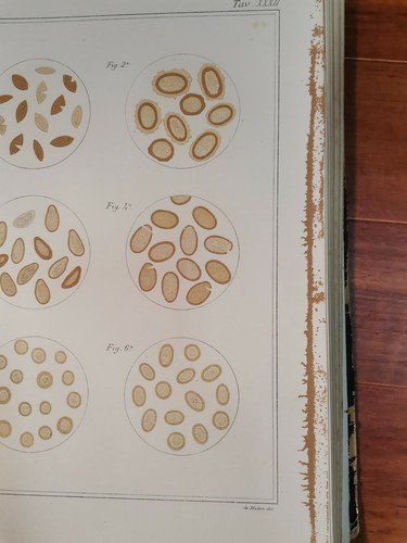 ATLANTE DI MICROSCOPIA CLINICA Gaetano Primavera 1886 Petruzzelli 68 litografie