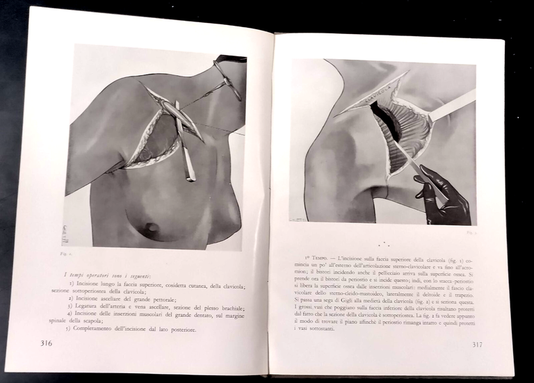ATLANTE TECNICA OPERAZIONI CHIRURGICHE volume 3 di A Ciminata 1939 …