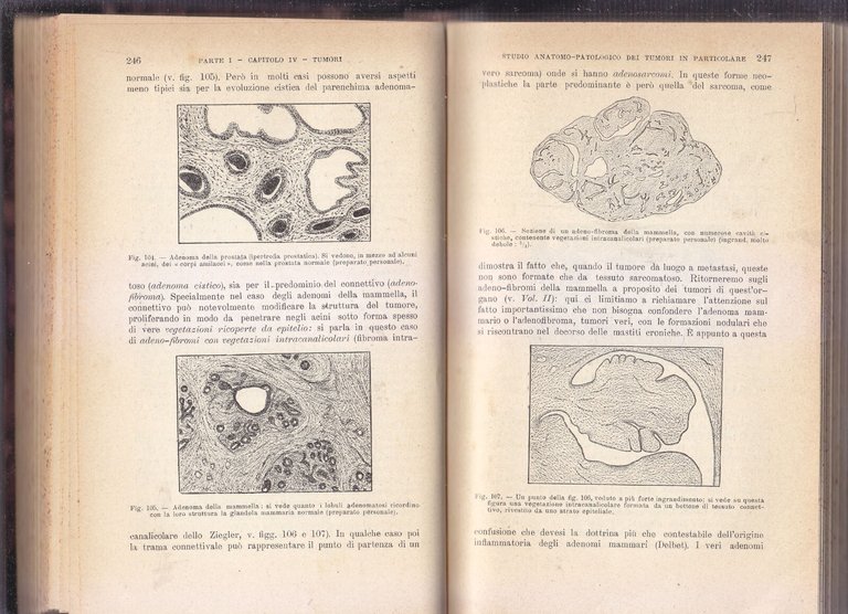 COMPENDIO DI PATOLOGIA CHIRURGICA Begouin Gosset 4 volumi COMPLETA 1924 …