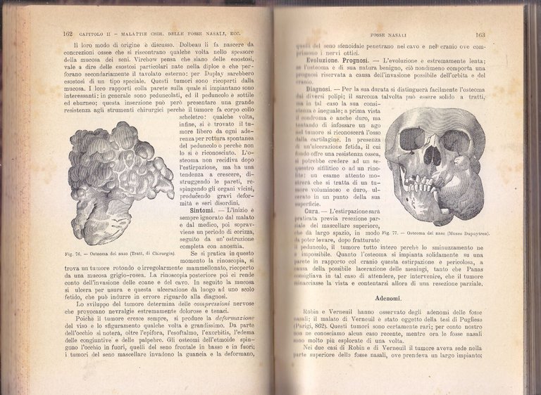 COMPENDIO DI PATOLOGIA CHIRURGICA Begouin Gosset 4 volumi COMPLETA 1924 …