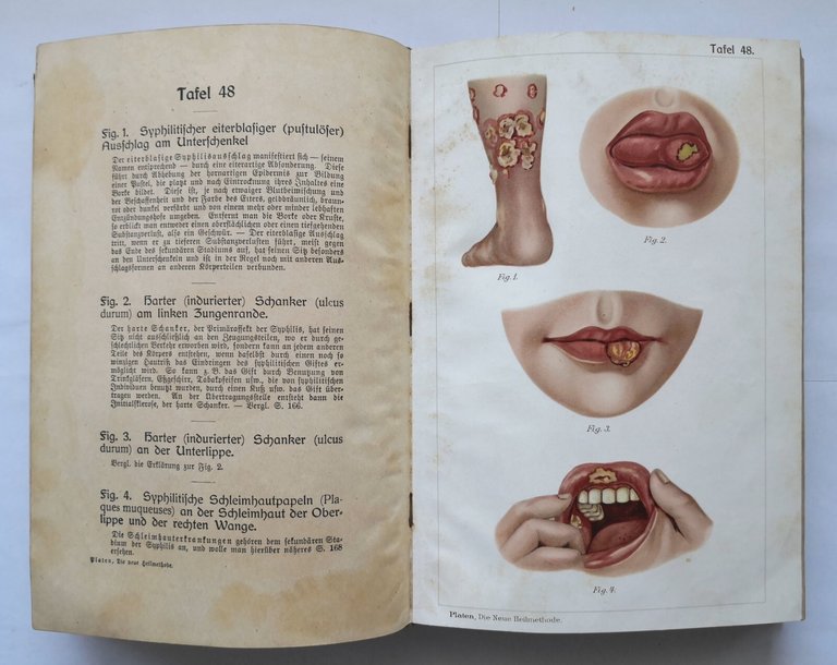 DIE NEUE HEILMETHODE di Platen volume IV 1907 Casa Editrice …