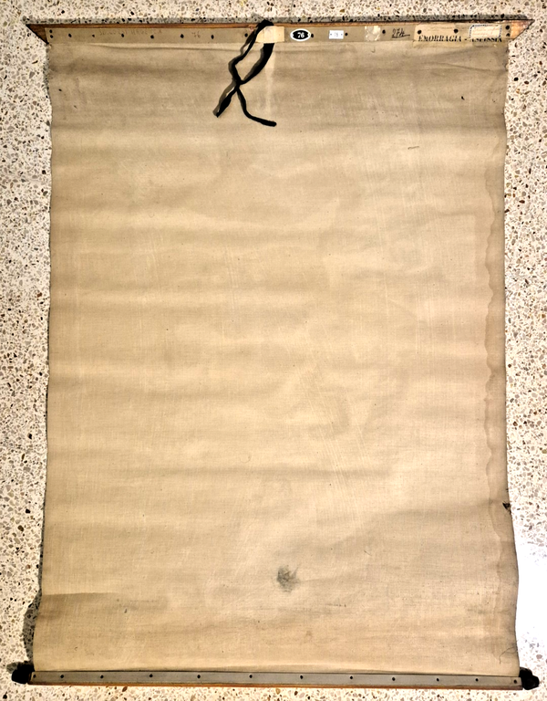 EMORRAGIA ASFISSIA POSTER DIDATTICO Vintage Tavola Paravia anni 30 infermieri