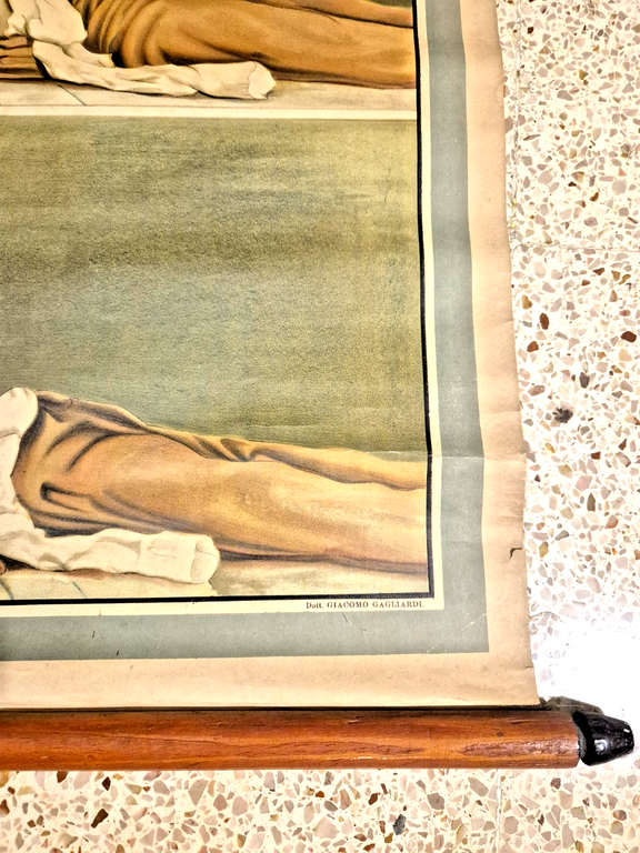 EMORRAGIA ASFISSIA POSTER DIDATTICO Vintage Tavola Paravia anni 30 infermieri