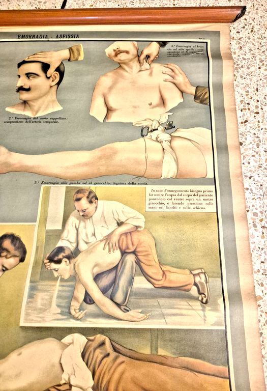 EMORRAGIA ASFISSIA POSTER DIDATTICO Vintage Tavola Paravia anni 30 infermieri