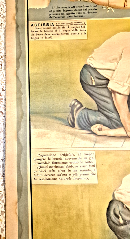 EMORRAGIA ASFISSIA POSTER DIDATTICO Vintage Tavola Paravia anni 30 infermieri