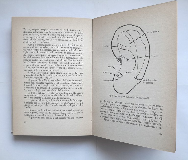 L'AGOPUNTURA CINESE di Alessandro Leccese 1982 Todariana Libro terapia medicina