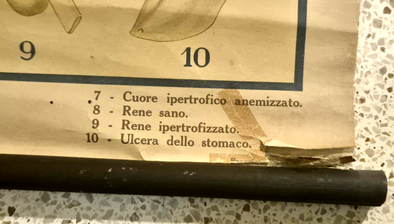 L'ALCOOLISMO lesioni organiche POSTER DIDATTICO Vintage Tavola Mondadori anni 30