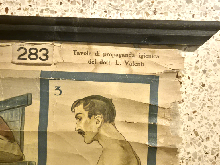 L'ALCOOLISMO lesioni organiche POSTER DIDATTICO Vintage Tavola Mondadori anni 30