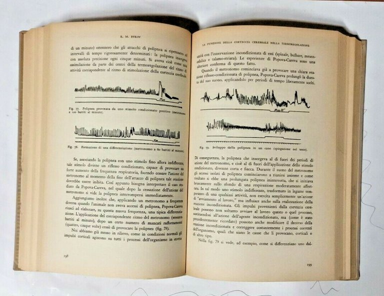 LA CORTECCIA CEREBRALE E GLI ORGANI INTERNI di K M …