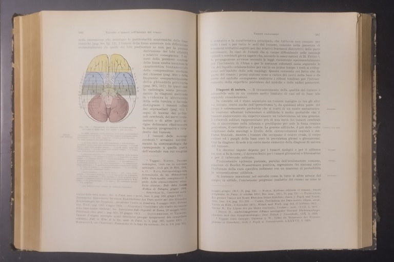LA DIAGNOSI CLINICA DELLE MALATTIE INTERNE VOLUME III di Ferrio … | Immagine Gallery 4