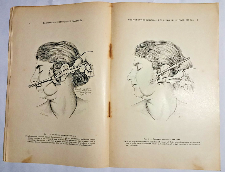 LA PRATIQUE CHIRURGICALE ILLUSTREE 1927 chirurgia estetica medicina libro vintag