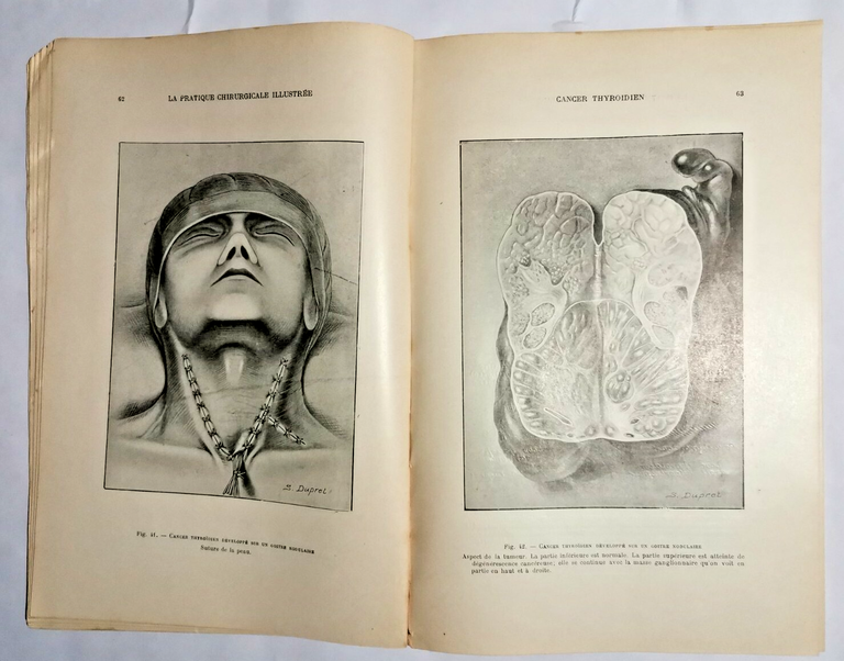 LA PRATIQUE CHIRURGICALE ILLUSTREE 1927 chirurgia estetica medicina libro vintag
