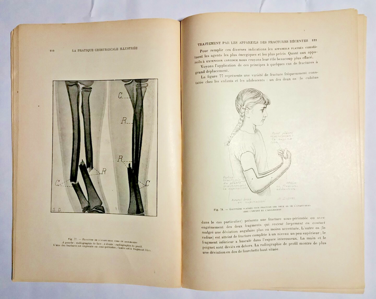 LA PRATIQUE CHIRURGICALE ILLUSTREE 1927 chirurgia estetica medicina libro vintag