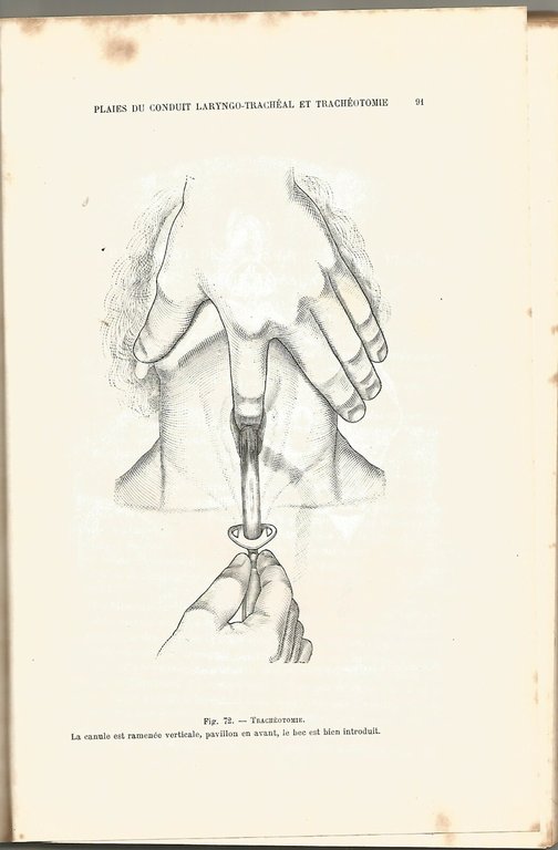 LA PRATIQUE CHIRURGICALE ILLUSTREE Victor Pauchet 1930 Doin fractures Libro