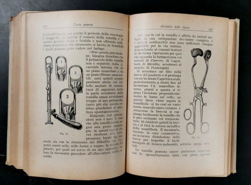MALATTIE DELL'ORECCHIO DEL NASO E DELLA GOLA laringoiatria di Mancioli …
