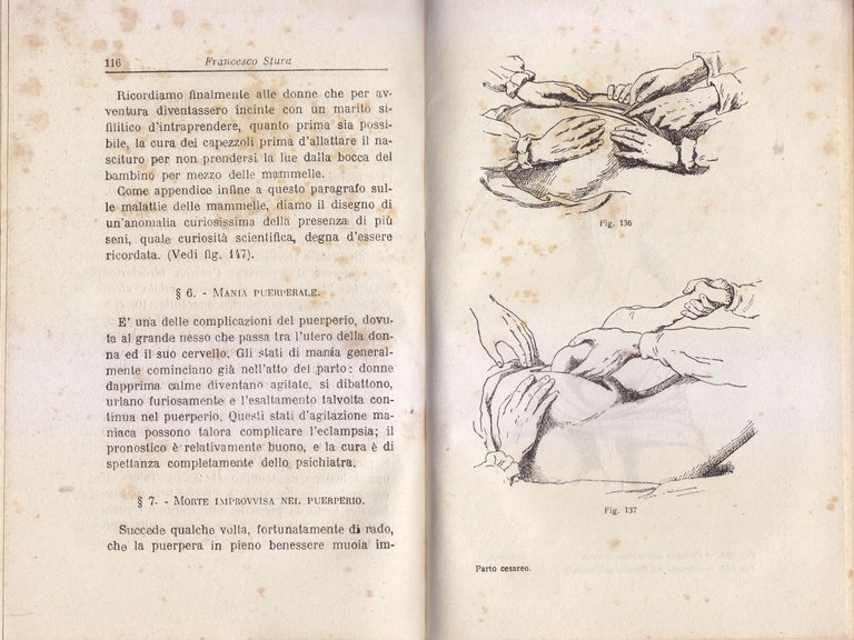 MATERNITÀ Dalla Fecondazione al Puerperio di Francesco Stura 1920 Libro …