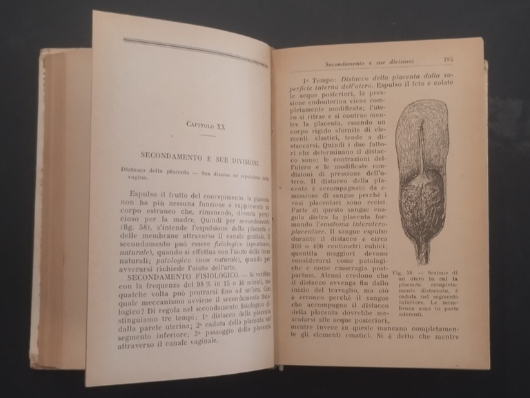 OSTETRICIA PRATICA ED OPERAZIONI OSTETRICHE di Renda 1926 Hoepli Libro …