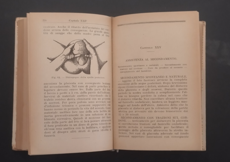 OSTETRICIA PRATICA ED OPERAZIONI OSTETRICHE di Renda 1926 Hoepli Libro …