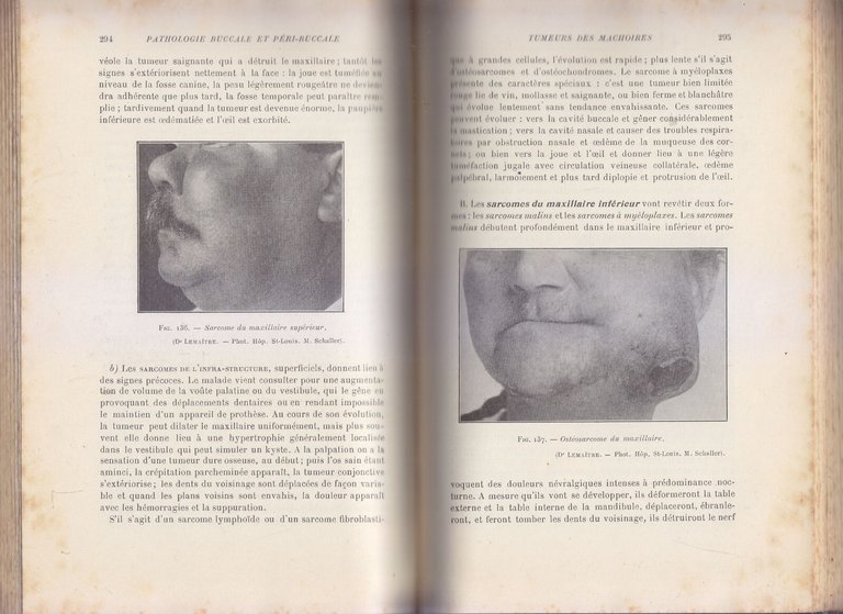 PATHOLOGIE BUCCALE PÉRI ET D'ORIGINE di Rousseau Decelle Et Raison …