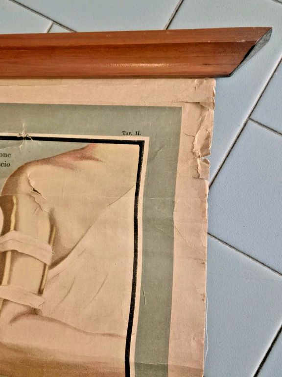 POSTER DIDATTICO SCOLASTICO Antico anni '20 Fratture Lussazioni Tavola Vallardi