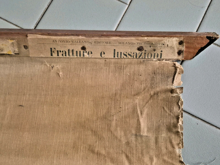 POSTER DIDATTICO SCOLASTICO Antico anni '20 Fratture Lussazioni Tavola Vallardi
