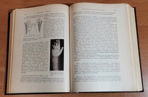 SEMEIOLOGIA DIAGNOSI E TERAPIA DELLE MALATTIE NERVOSE di Mattirolo 1944 …