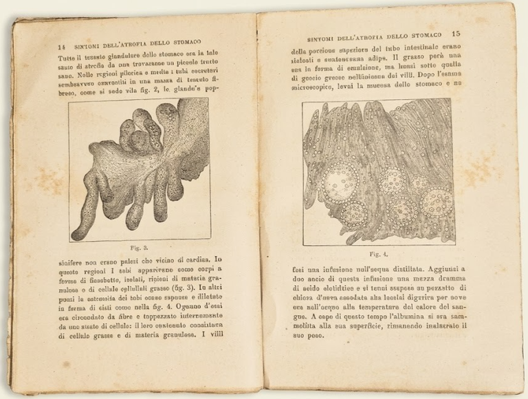SULL'ATROFIA DELLO STOMACO E MALATTIE NERVOSE ORGANI DIGERENTI di S … | Immagine Gallery 6