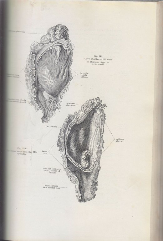 TRATTATO COMPLETO DI OSTETRICIA di Ernesto Bumm 1909 Libro vintage …