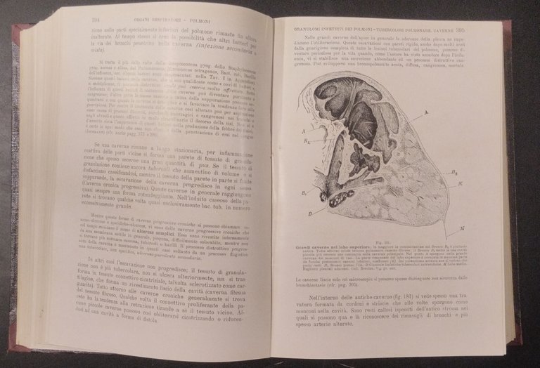 TRATTATO DI ANATOMIA PATOLOGICA SPECIALE 3 Volumi Kaufmann 1925 Vallardi …