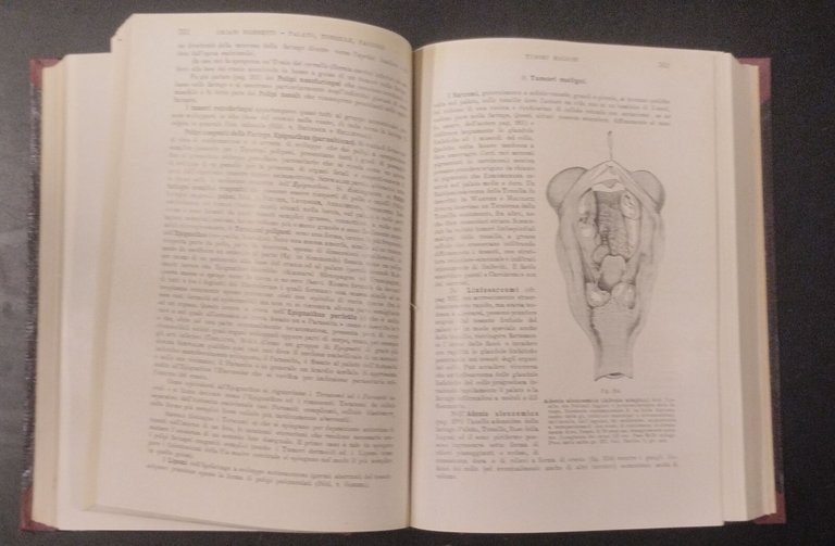TRATTATO DI ANATOMIA PATOLOGICA SPECIALE 3 Volumi Kaufmann 1925 Vallardi …