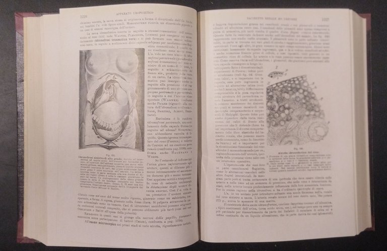 TRATTATO DI ANATOMIA PATOLOGICA SPECIALE 3 Volumi Kaufmann 1925 Vallardi …