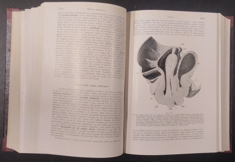 TRATTATO DI ANATOMIA PATOLOGICA SPECIALE 3 Volumi Kaufmann 1925 Vallardi …