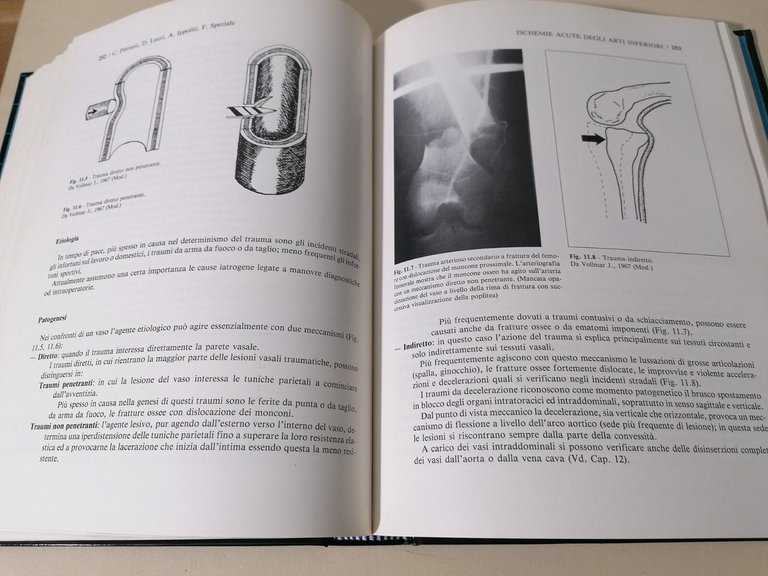 Elementi di Patologia e Chirurgia Vascolare Libro Delfino Editore 1988 …