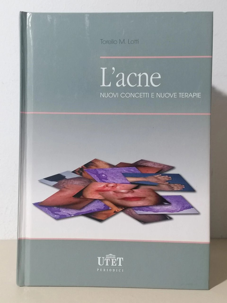 L'Acne Nuovi Concetti e Nuove Terapie Libro Lotti UTET 8879332562 …