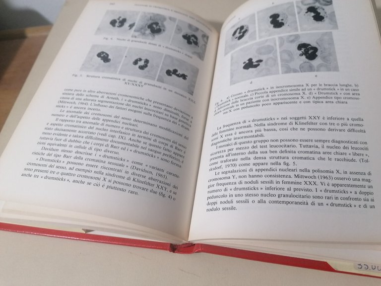 Metodi Nella Citogenetica Umana Libro Schwarzacher Wolf Piccin 1978 Raro