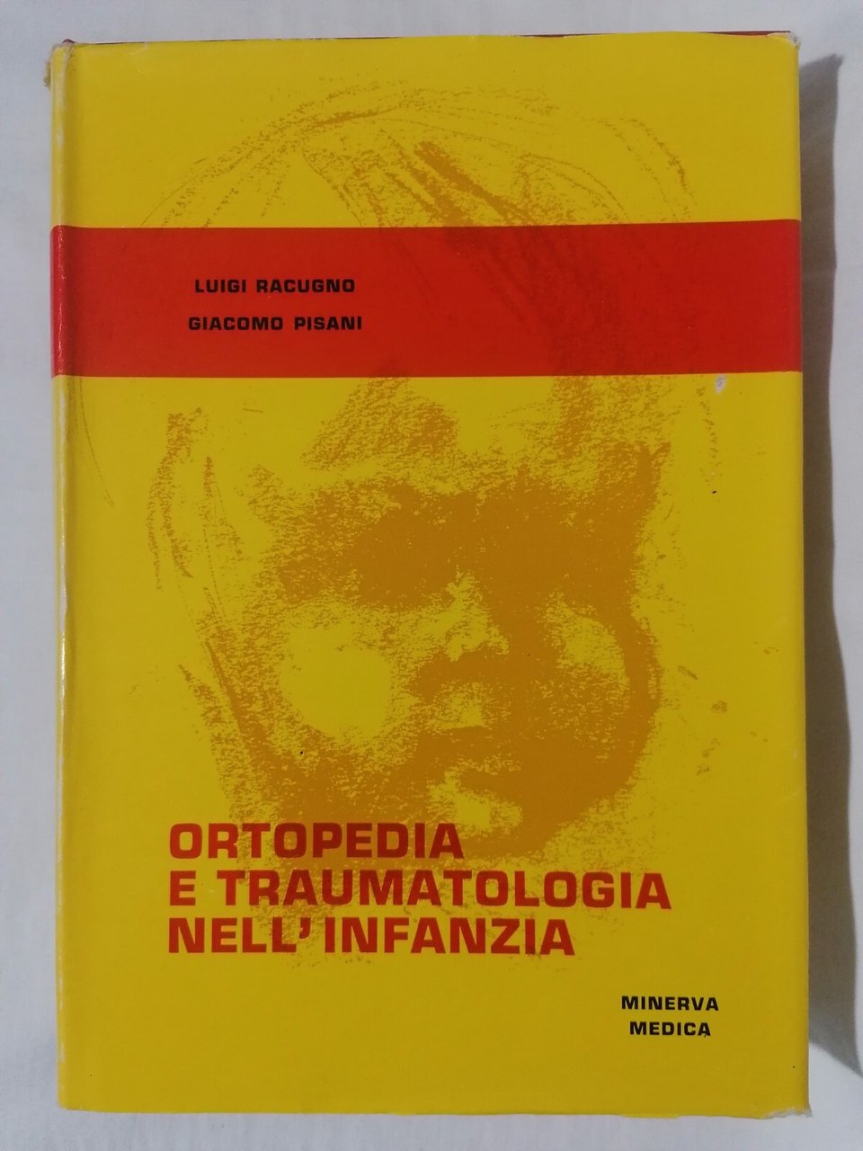 Ortopedia e Traumatologia nell'Infanzia - Libro trattato Racugno Pisani 1963
