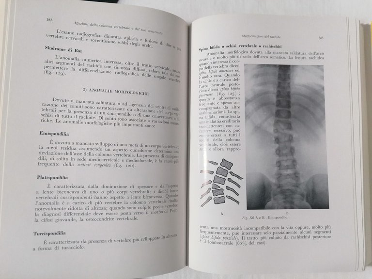 Ortopedia e Traumatologia nell'Infanzia - Libro trattato Racugno Pisani 1963