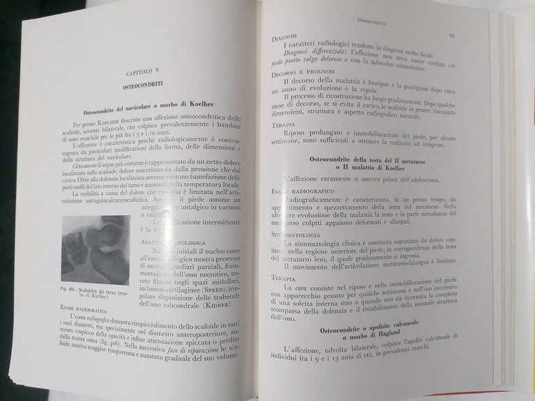 Ortopedia e Traumatologia nell'Infanzia - Libro trattato Racugno Pisani 1963