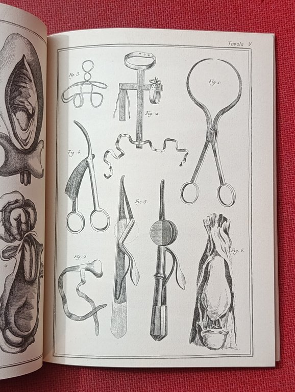 Ragguaglio degli strumenti chirurgici del secolo XVIII