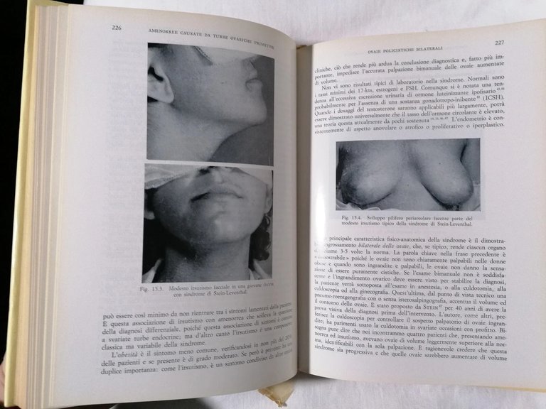 Turbe Mestruali e Sterilità - Libro Leon Israel Piccin editore …